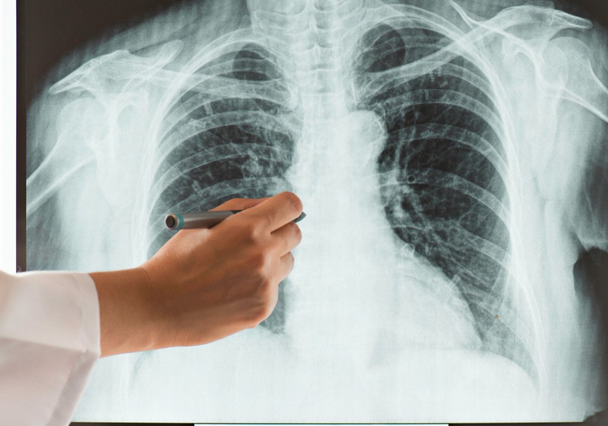 Workshop on calibration of dosimeters for X-ray imaging 🩻

📍 EEAE, Athens, Greece
 🗓️ 1-3 September 2025

🎓 Covering calibration procedures, uncertainties, hands-on training and more
👥 Hosted by #Partnership project #TraMeXI

Register now 👉 bit.ly/4ln5kdJ