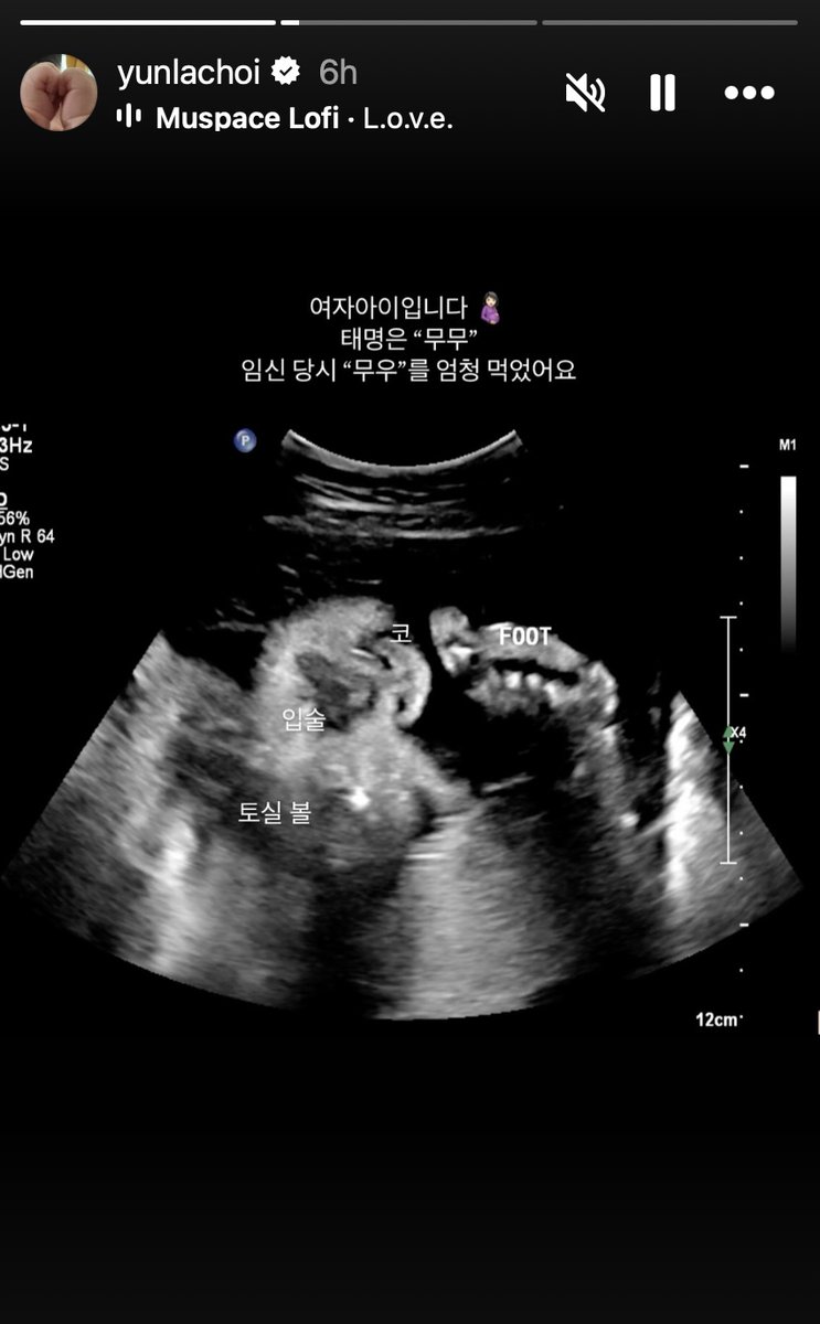 revistakoreain's tweet photo. Por meio de fotos nas redes sociais, #ChoiYoonRa compartilhou com os fãs que está à espera de seu primeiro filho.

A atriz se casou em novembro do ano passado com seu marido não celebridade.

cr: Soompi https://t.co/IpOqZR5EHA