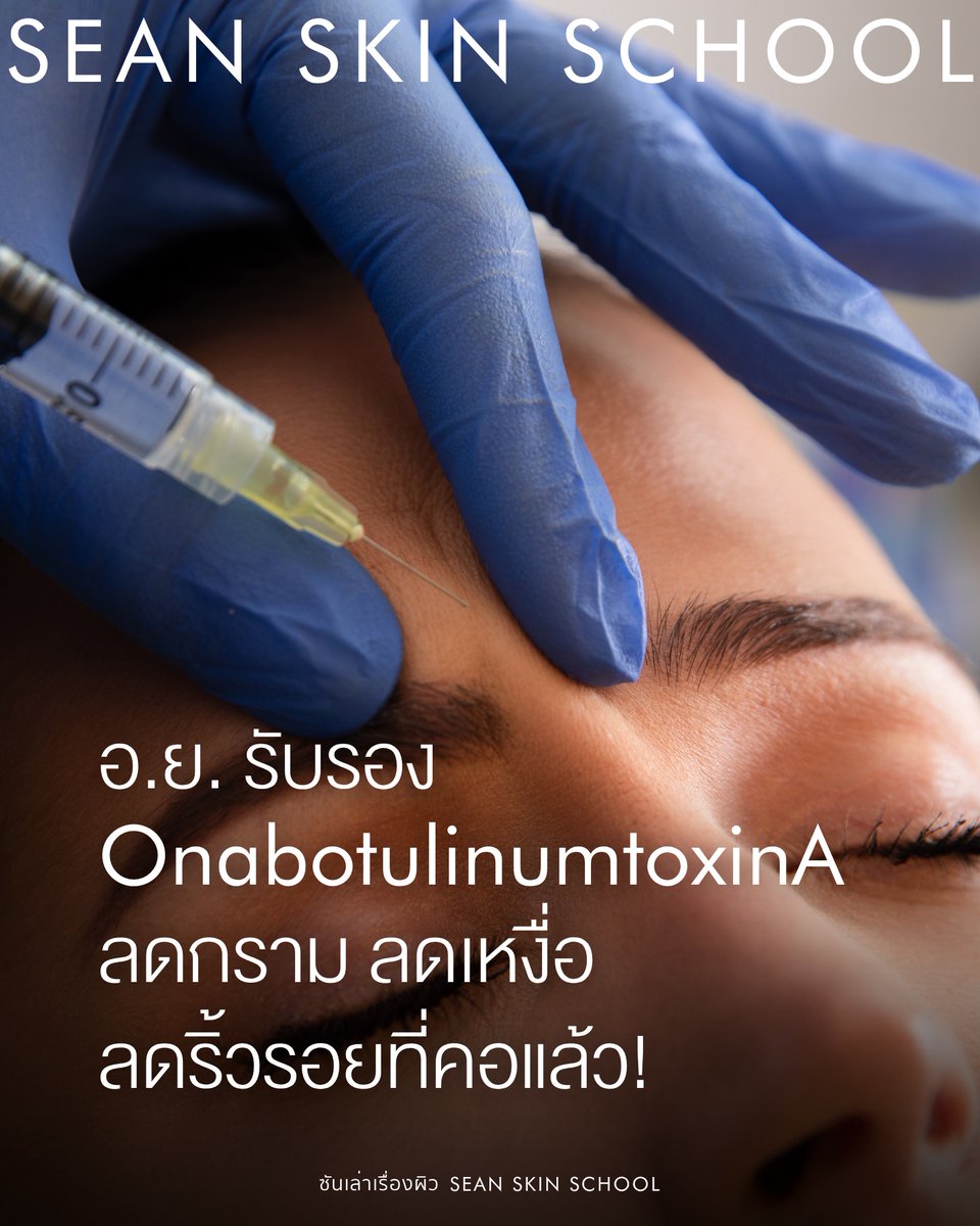 อ.ย. รับรอง OnabotulinumtoxinA ลดกราม ลดเหงื่อ ปรับกล้ามเนื้อคอแล้ว!

ซันตื่นเต้นเสมอเวลามีนวัตกรรมใหม่ๆ ที่มาช่วยให้ดูแลคนไข้ได้ดีขึ้น วันนี้เลยอยากมาอัพเดทเกี่ยวกับ OnabotulinumtoxinA ที่ได้พัฒนาไปไกลกว่าแค่การรักษาริ้วรอยบนใบหน้าส่วนบนแล้วครับ

ข่าวดีล่าสุดคือ ตอนนี้