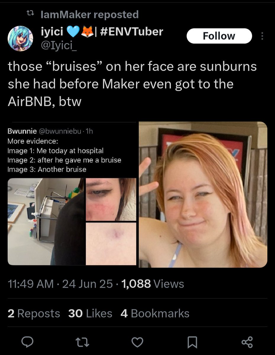 Something637321's tweet photo. @TheGat_AndOnly However, it was quickly pointed out that she (of her own will) booked a private room with Maker afterwards and wanted to initiate more intimacy along with those bruises being sunburns. (2) https://t.co/EvNwlWXz9Z