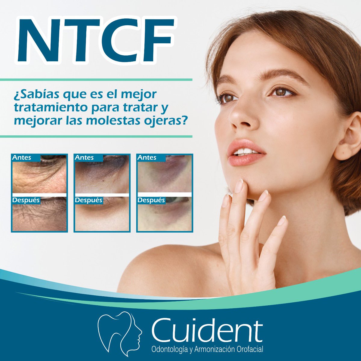 cuident1's tweet image. Excelente tratamiento para ojeras e hidratación de la piel.