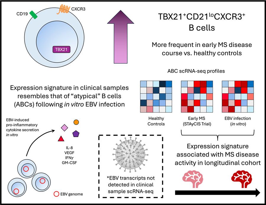 JCI insight (@jci_insight) on Twitter photo Epstein-Barr virus is a proposed trigger of multiple sclerosis, but the involvement of virus-infected B cells has remained unclear.
<a href="/TheLuftigLab/">Luftig Lab</a> & team <a href="/PittTweet/">University of Pittsburgh</a> now identify atypical B cells expressing CXCR3, immune checkpoint molecules, and an EBV-associated pro-inflammatory Epstein-Barr virus is a proposed trigger of multiple sclerosis, but the involvement of virus-infected B cells has remained unclear.
<a href="/TheLuftigLab/">Luftig Lab</a> & team <a href="/PittTweet/">University of Pittsburgh</a> now identify atypical B cells expressing CXCR3, immune checkpoint molecules, and an EBV-associated pro-inflammatory