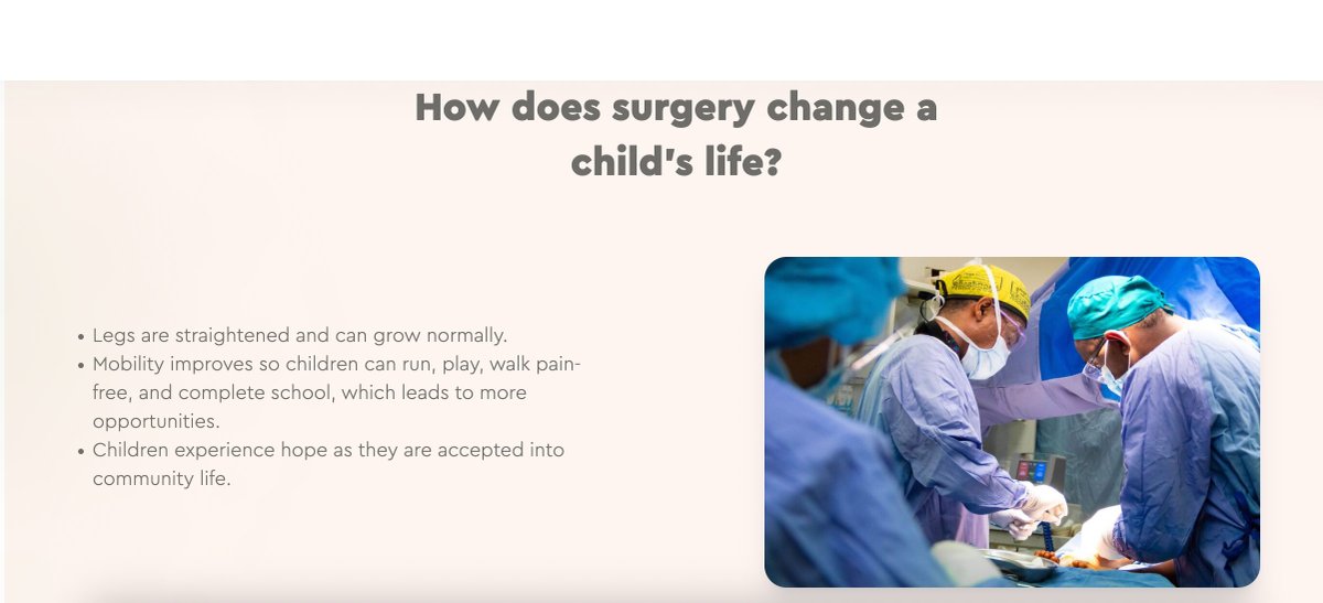 #ServicesWeProvide
#BowedLegSurgery
Bowed legs is a condition where the legs bend outwards around or below the knees, even when the ankles are together. 
To learn more about CURE Children's Hospital of Ethiopia and the conditions we treat, please visit ethiopia.cure.org.