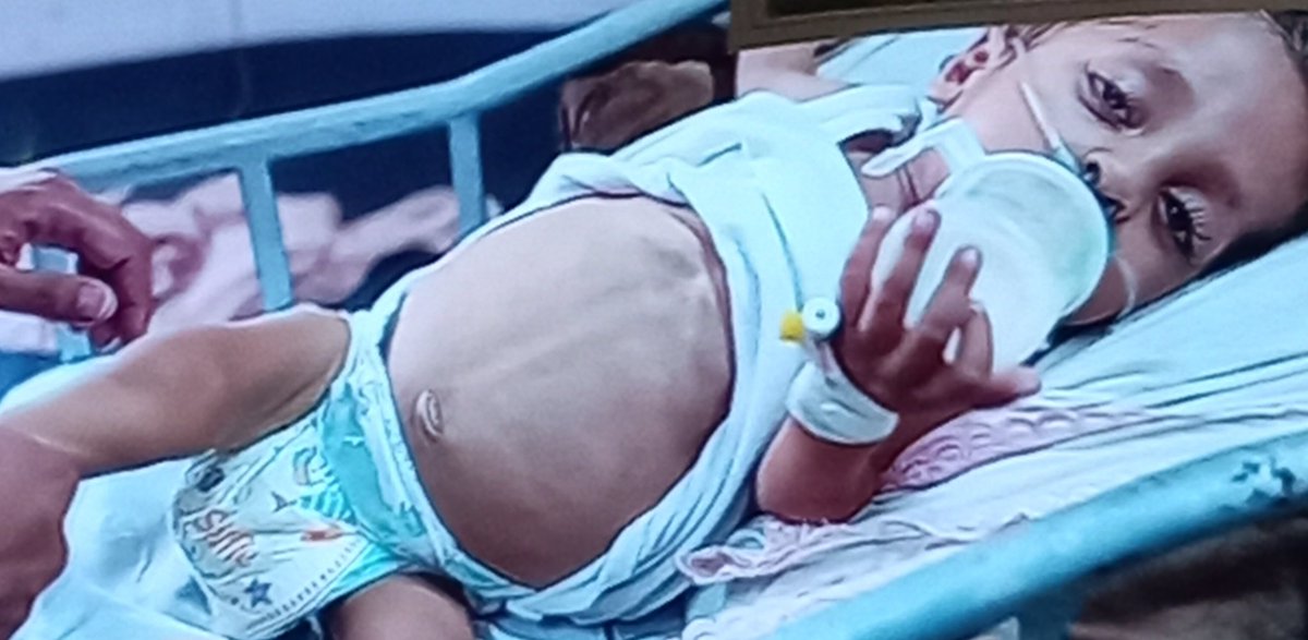 What is going on in the  Gaza Genocide is heartbreaking.

It is safe to say that humanity has not only failed the Palestinians, but it has failed us all.

How can one allow such  pain to  be inflicted on society's most vulnerable.

This 3 year old died of malnutrition 2 days ago.