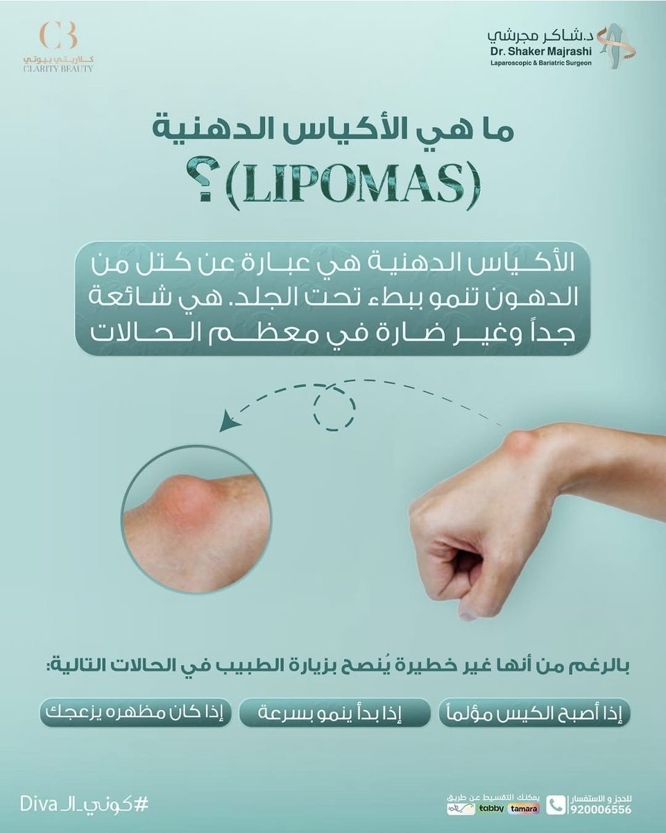 drshakerr's tweet photo. تعاني من انتفاخات تحت الجلد ... قد تكون أكياس دهنية ... تعرف عليها
#شاكر_مجرشي 
#السمنة 
#التكميم 
#جراحة https://t.co/7ABWsp93Pl