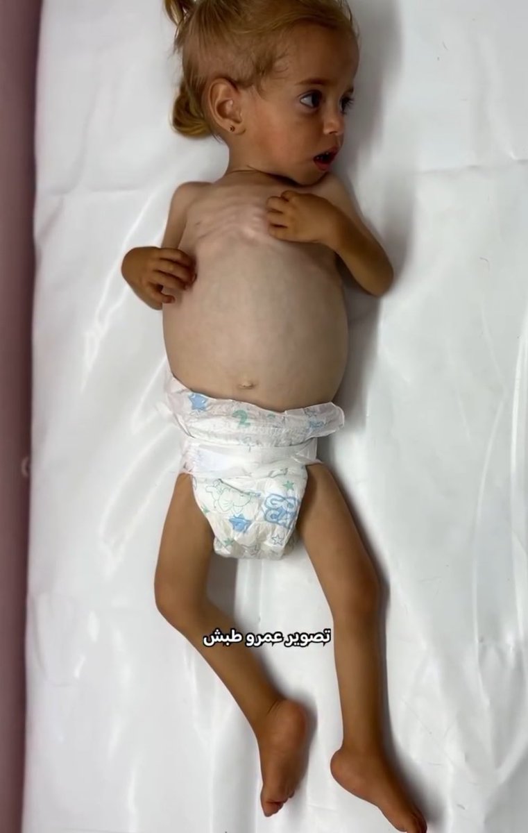 Dr. Yousef 🇵🇸 tweet media