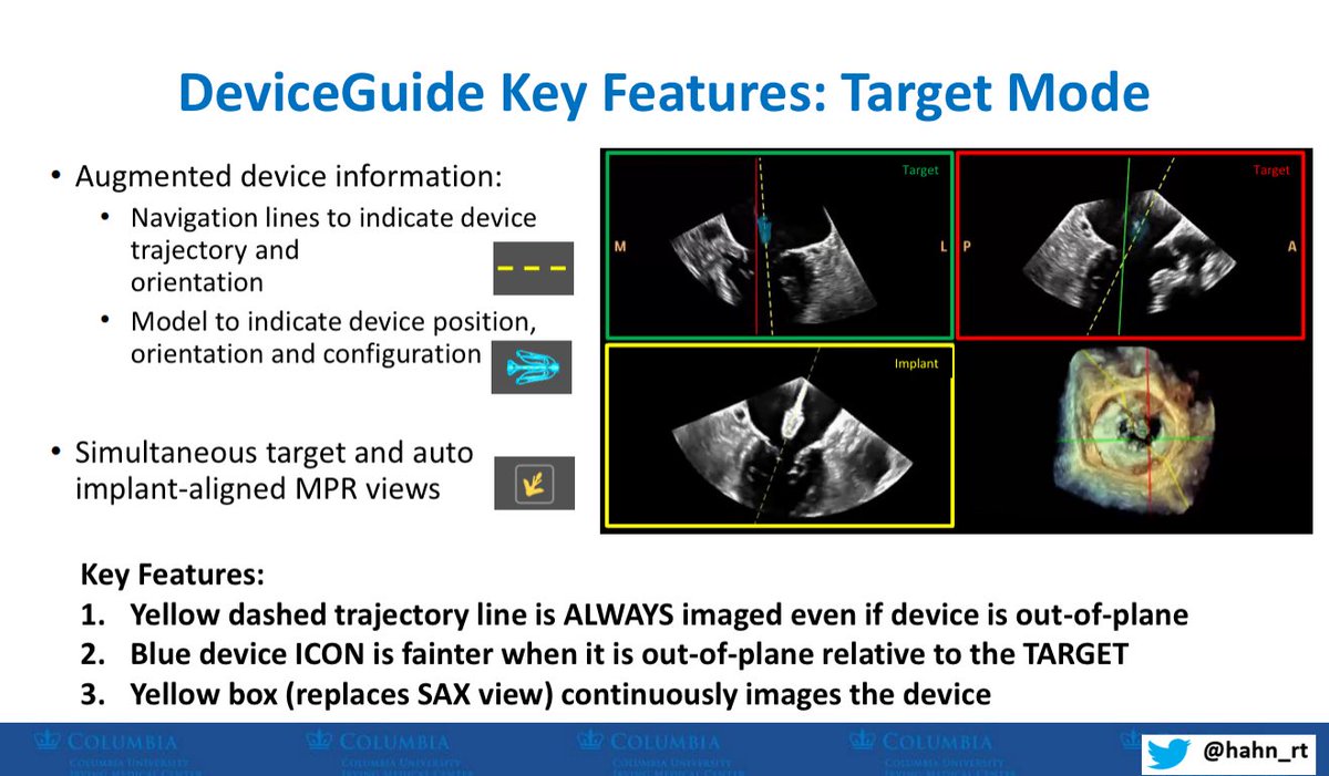 Come some see a novel AI system to guide M-TEER: DeviceGuide!!  Presentation at 3:30 in room 411!! <a href="/crfheart/">Cardiovascular Research Foundation</a> <a href="/TCTMD/">TCTMD</a> #NYValves2025