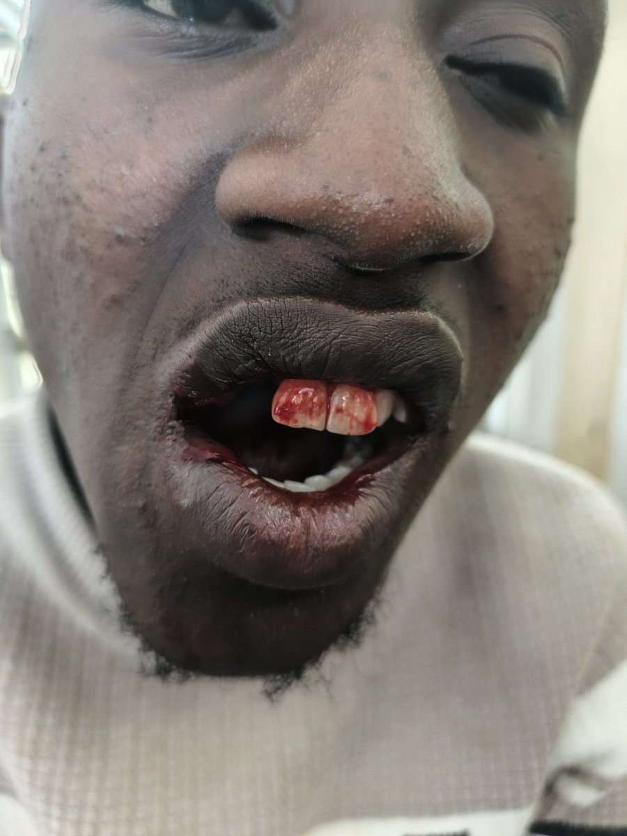 We used our as our media in Narok , All mainstream and local media went to Narok county assembly to Cover Budget reading
Shame on them