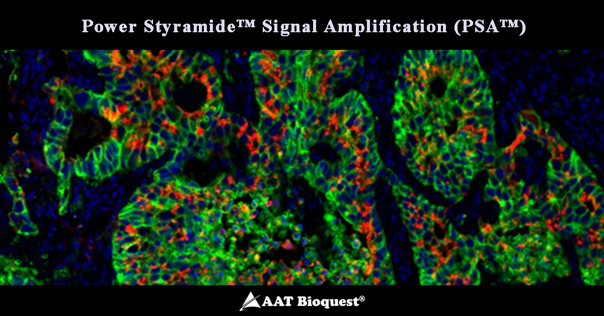✨#Catalog Spotlight: Power Styramide™ Signal Amplification (PSA™): The Unmatched Solution for Rare Target Detection🚀

Achieve up to 50x greater sensitivity compared to TSA with PSA™, engineered with enhanced reagent at every amplification steps. 

aatbio.com/catalog/power-…