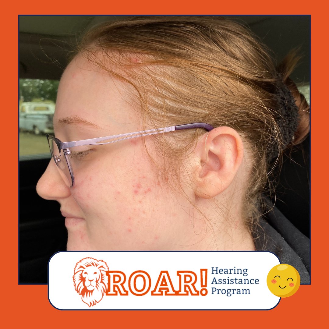 Update on Melissa! 💙🦁
She’s loving her new hearing aids—and especially how the tubing is barely noticeable! With help from the Roseburg Lions and OLSHF, she’s gaining both confidence and independence.