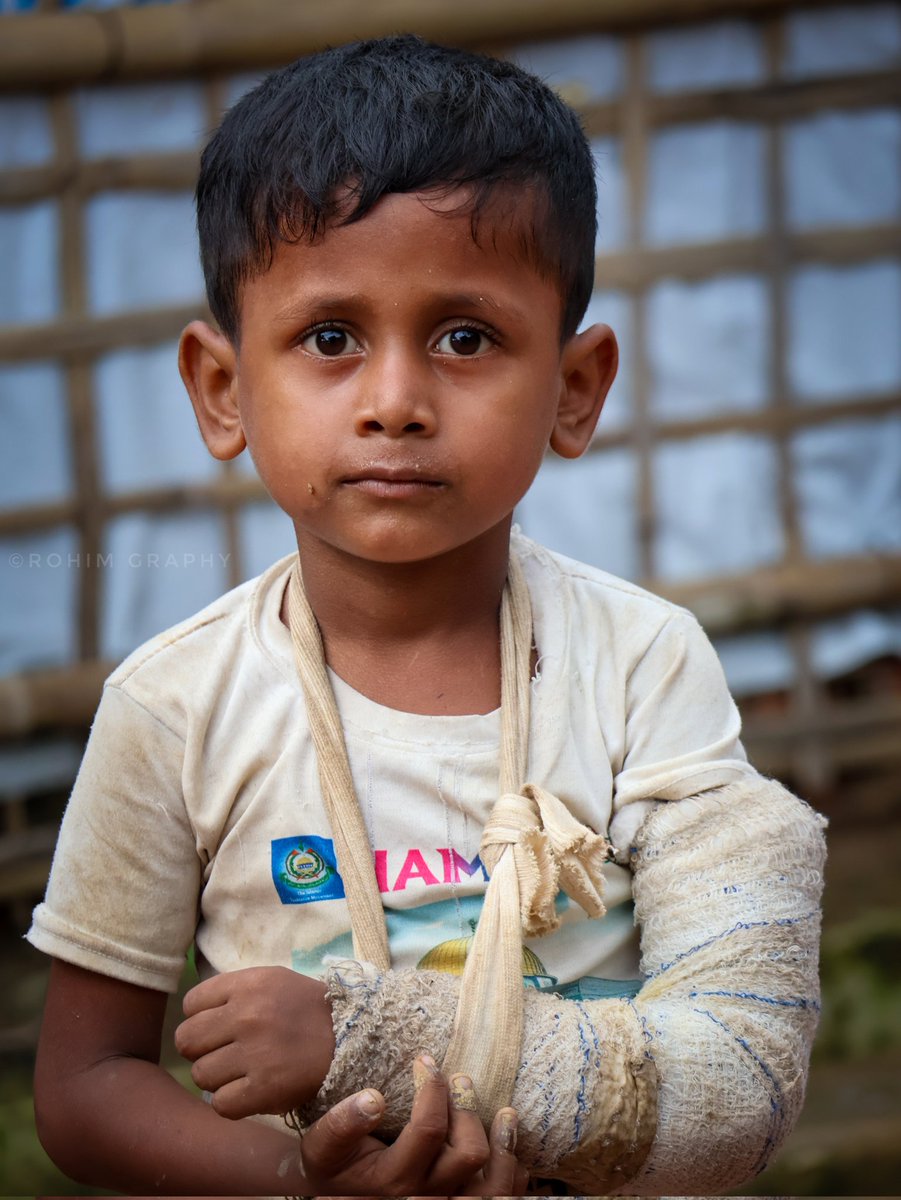 Wounded and Broken

A Rohingya refugee boy covers his injured hand, bearing silent suffering in a refugee camp where medical care is limited when it is needed most

#Rohingya #Refugees #RefugeeChildren
#InnocentLives #HealthForAll #RefugeeLife
#RefugeeCamp

📸 <a href="/CFWRohimUllah/">CFW Rohim Ullah</a>