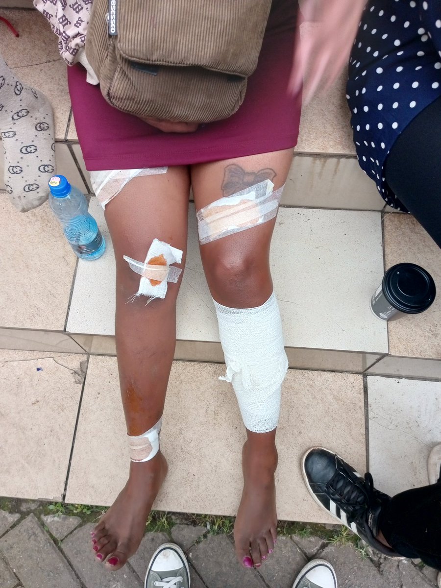 This gal has been hurt, na akaibiwa she needs like 700 afike home, aki she's in distress.
Can someone send it nimlipie aende home?