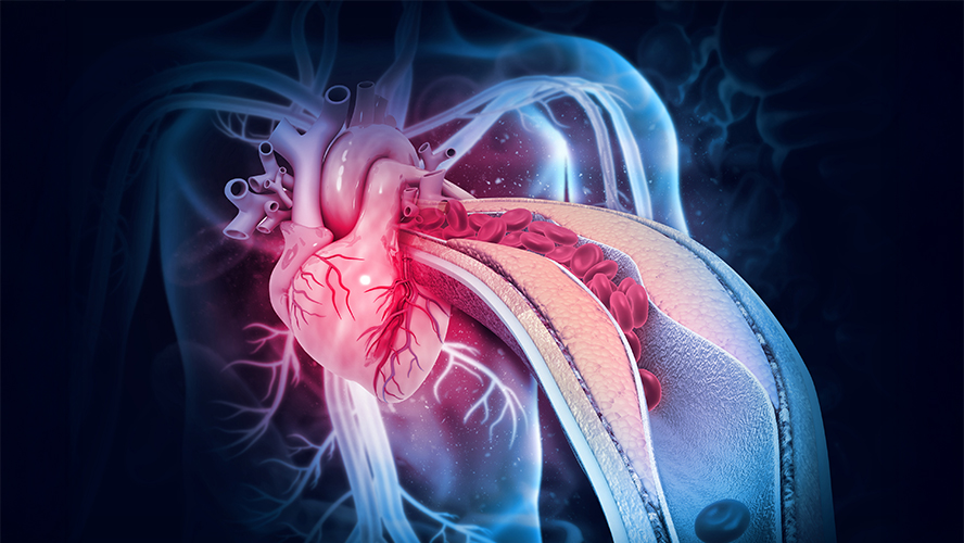 UHN Research (@uhn_research) on Twitter photo This #StrokeAwarenessMonth, a team led by Dr. <a href="/kat_howe/">Kathryn Howe</a> from <a href="/UHN/">University Health Network</a>’s <a href="/TGHRI_UHN/">Toronto General Hospital Research Institute</a> reveals how blood vessels cells send tiny messages that may trigger plaque rupture and stroke, generating a first-of-its-kind model to help investigate further.
🔗 Read more: uhnresearch.ca/news/how-arter… This #StrokeAwarenessMonth, a team led by Dr. <a href="/kat_howe/">Kathryn Howe</a> from <a href="/UHN/">University Health Network</a>’s <a href="/TGHRI_UHN/">Toronto General Hospital Research Institute</a> reveals how blood vessels cells send tiny messages that may trigger plaque rupture and stroke, generating a first-of-its-kind model to help investigate further.
🔗 Read more: uhnresearch.ca/news/how-arter…