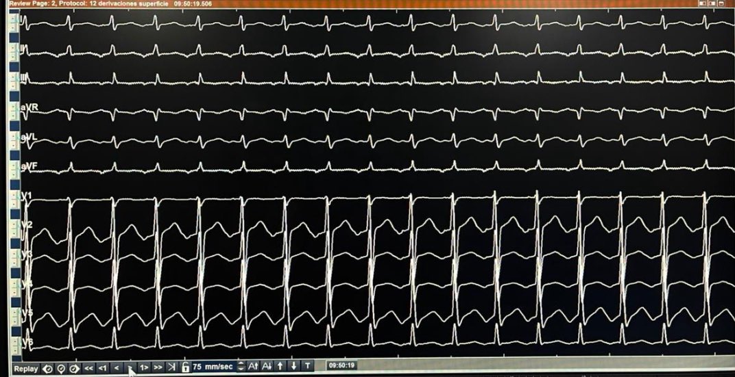 ALBERTO ALFIE tweet media