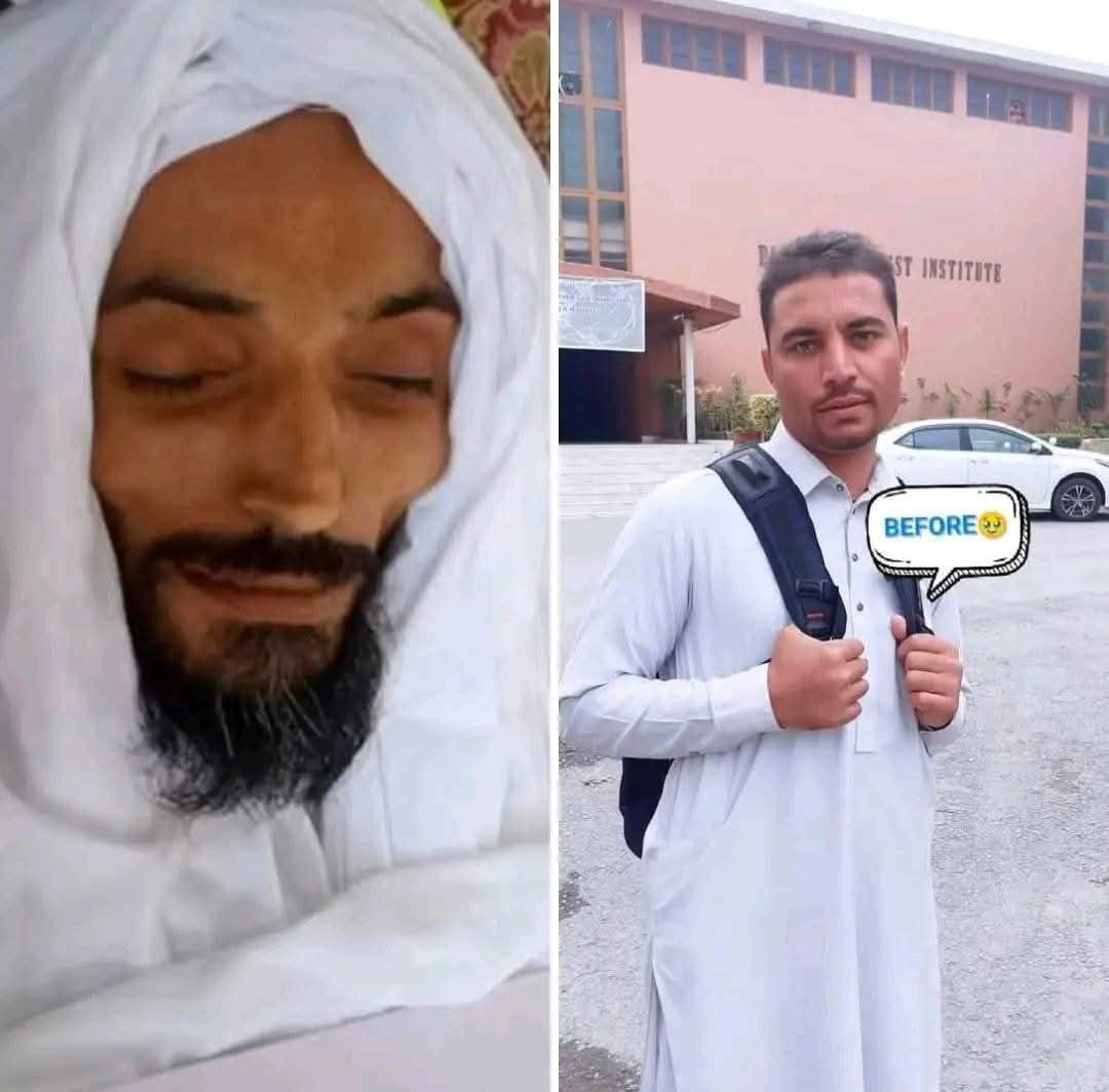 aima_kh's tweet photo. An Alive Soul turned in to a corpse

Taj Manullah, a young student from North Waziristan, was finally martyred during a variety of violence in the army torture cell for six years,

The aggressive State has Never ended the kill and dump policy.  #StopPashtunGenocide https://t.co/n9HnD2Gj6B
