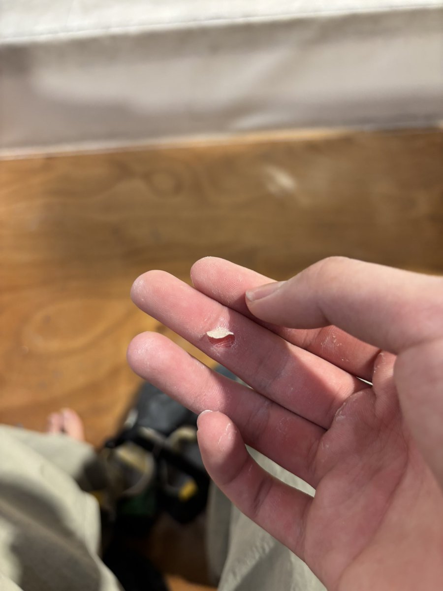 I'm doing what I love - rock climbing! And, oops, I got a tiny cut on my finger. :p But it's worth it, because I'm too busy having a blast climbing! I love the challenge and adrenaline rush that comes with it.