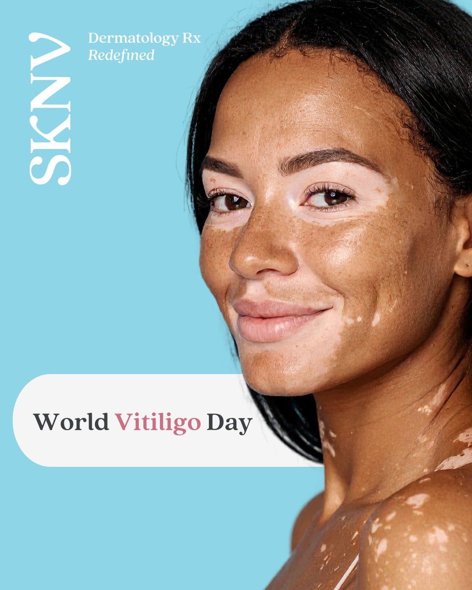 Today is World Vitiligo Day 🤍
Vitiligo affects millions of people around the world—and yet, awareness and understanding are still evolving.

This day is about recognition, education, and celebrating the beauty of all skin tones and patterns. It’s also a moment to amplify the