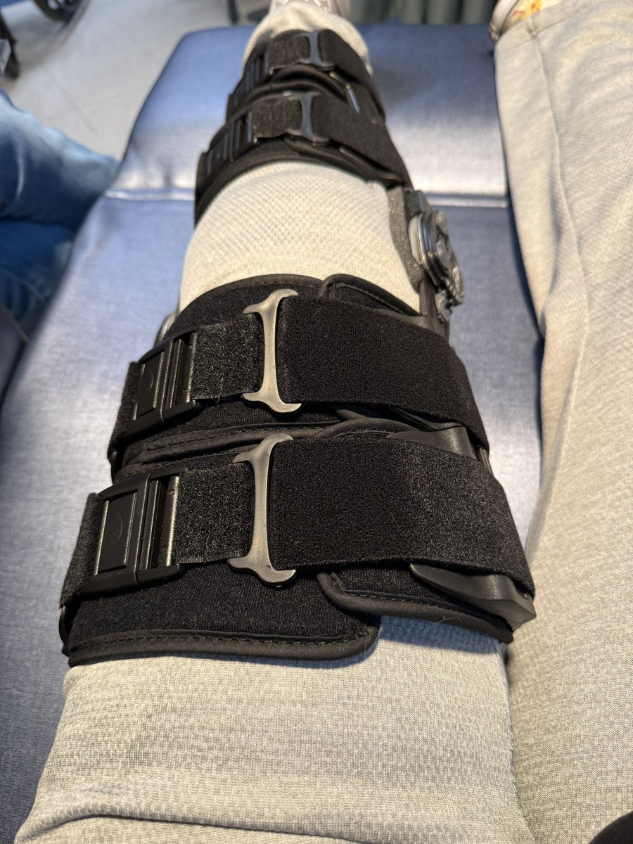 Just completed my first of potentially many lifelong surgeries. 

I had a Fulkerson Osteotomy today. Essentially they cut out a part of my tibia to realign it, securing it with screws. 

I have been fighting with this knee since I was 12 years old, and it was actually the first