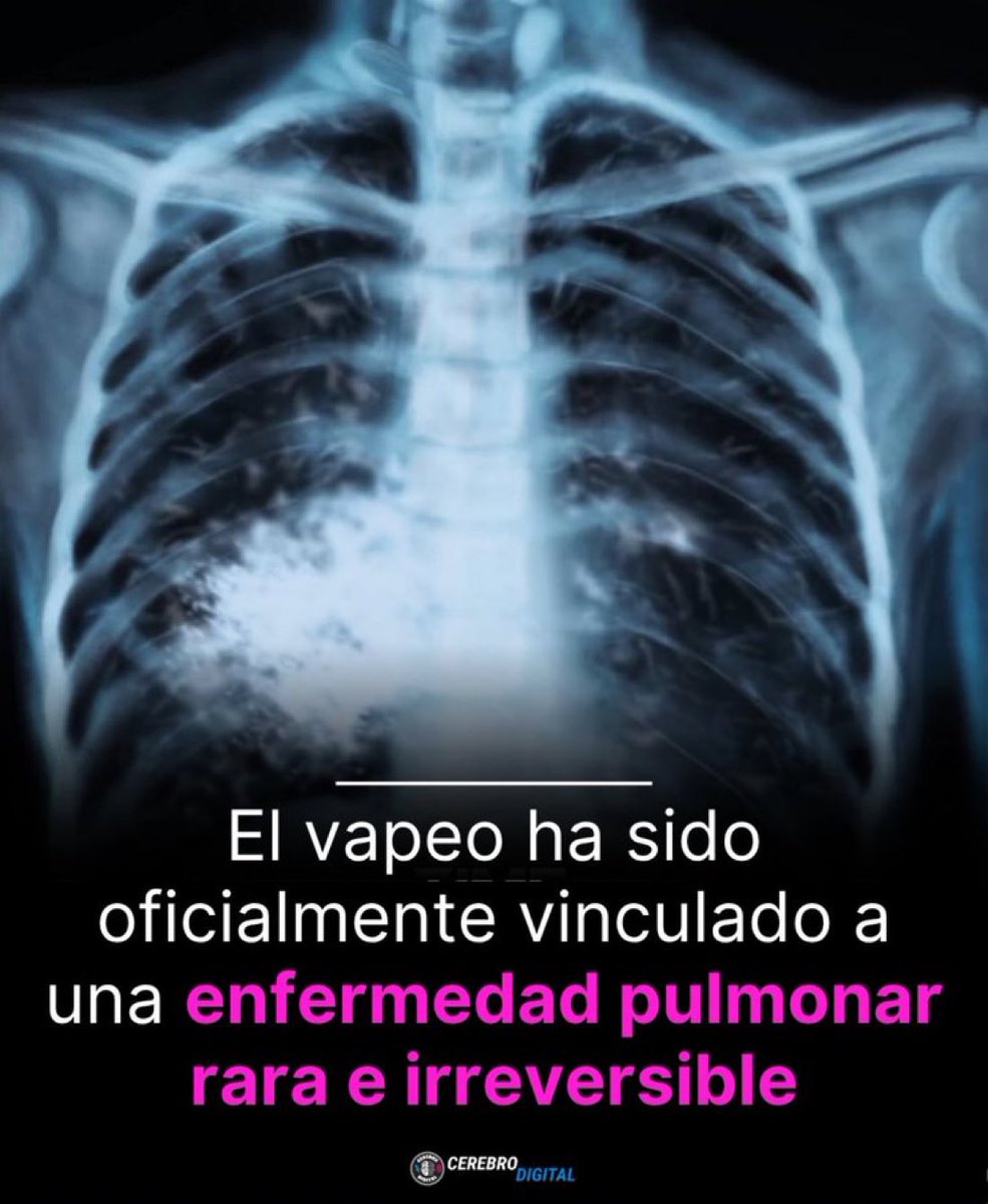 Roi Lopez Rivas (@roilopezrivas) on Twitter photo 