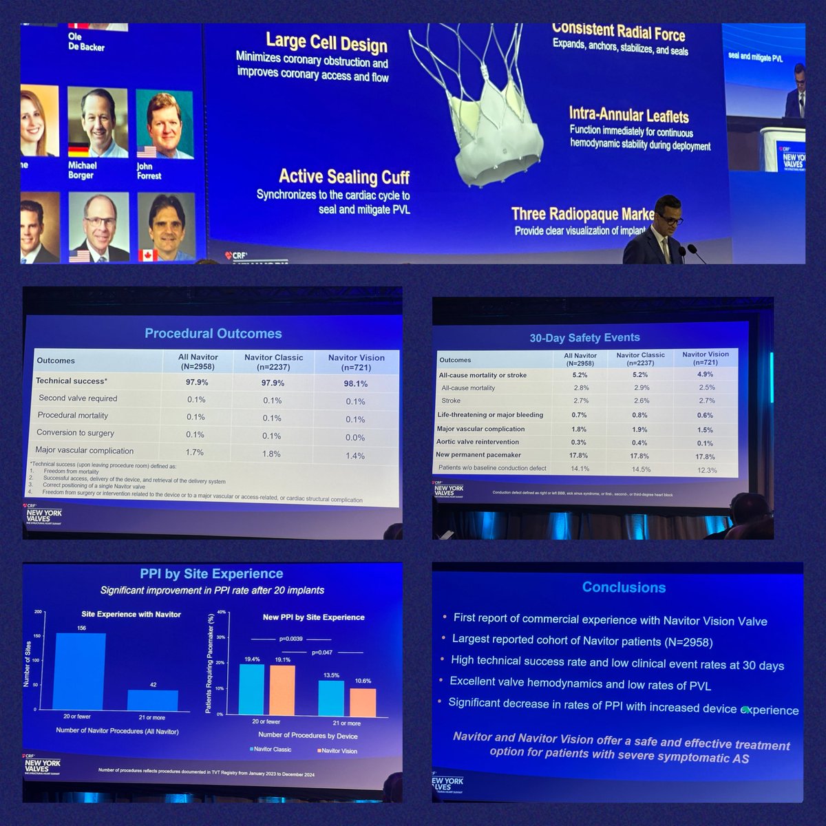 omendiz's tweet image. Navitor Experience in USA presented by Santiago Garcia at #NYValves2025 in LBT session