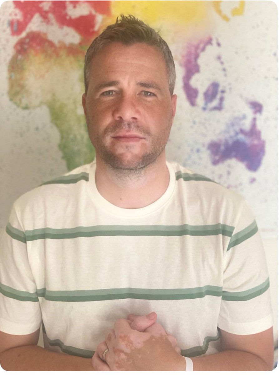 25th of June World Vitiligo Day- a lot of worse things to have in the world and going on right now but one day to highlight it, pardon the pun #vitiligo