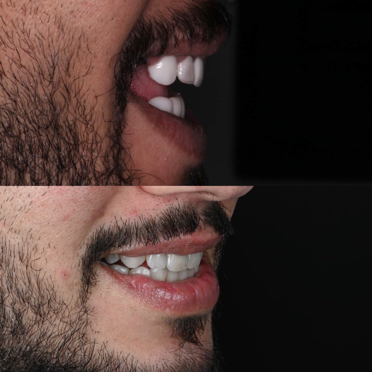 Areeb J Alotaibi tweet media