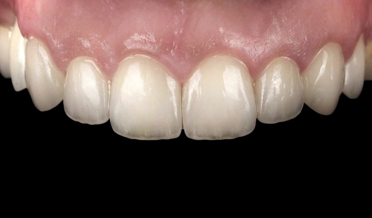 Areeb J Alotaibi tweet media