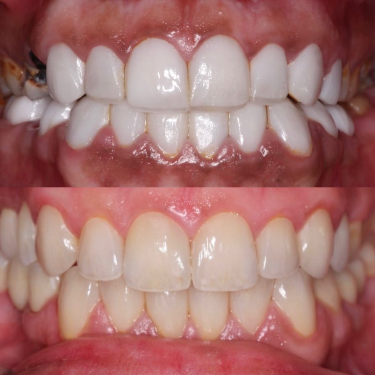 Areeb J Alotaibi tweet media