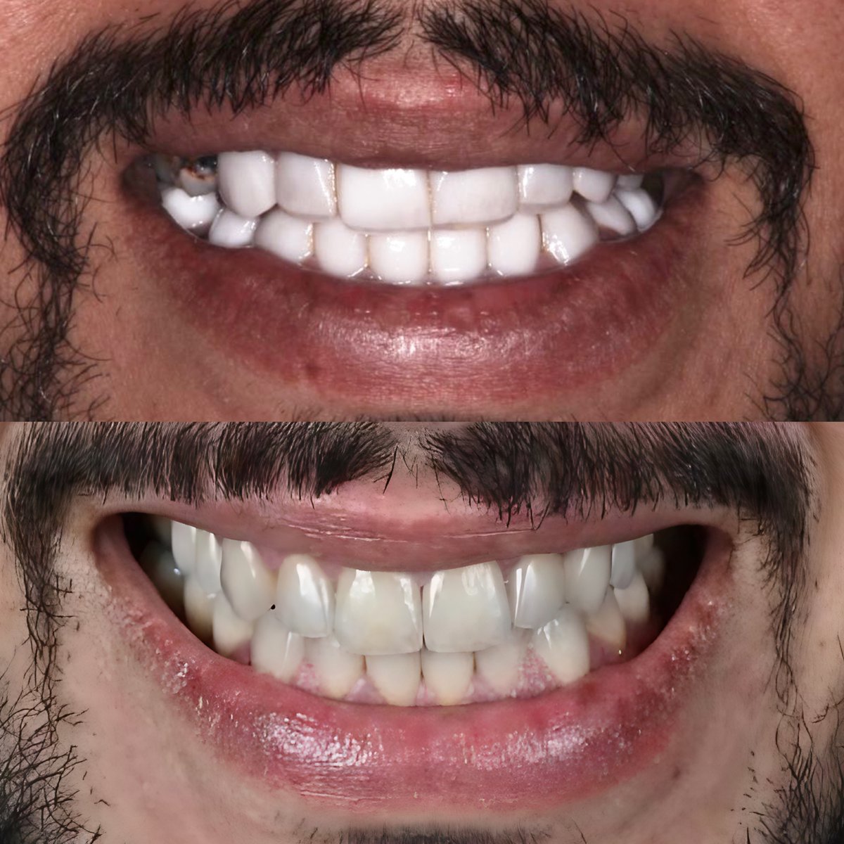 Areeb J Alotaibi tweet media