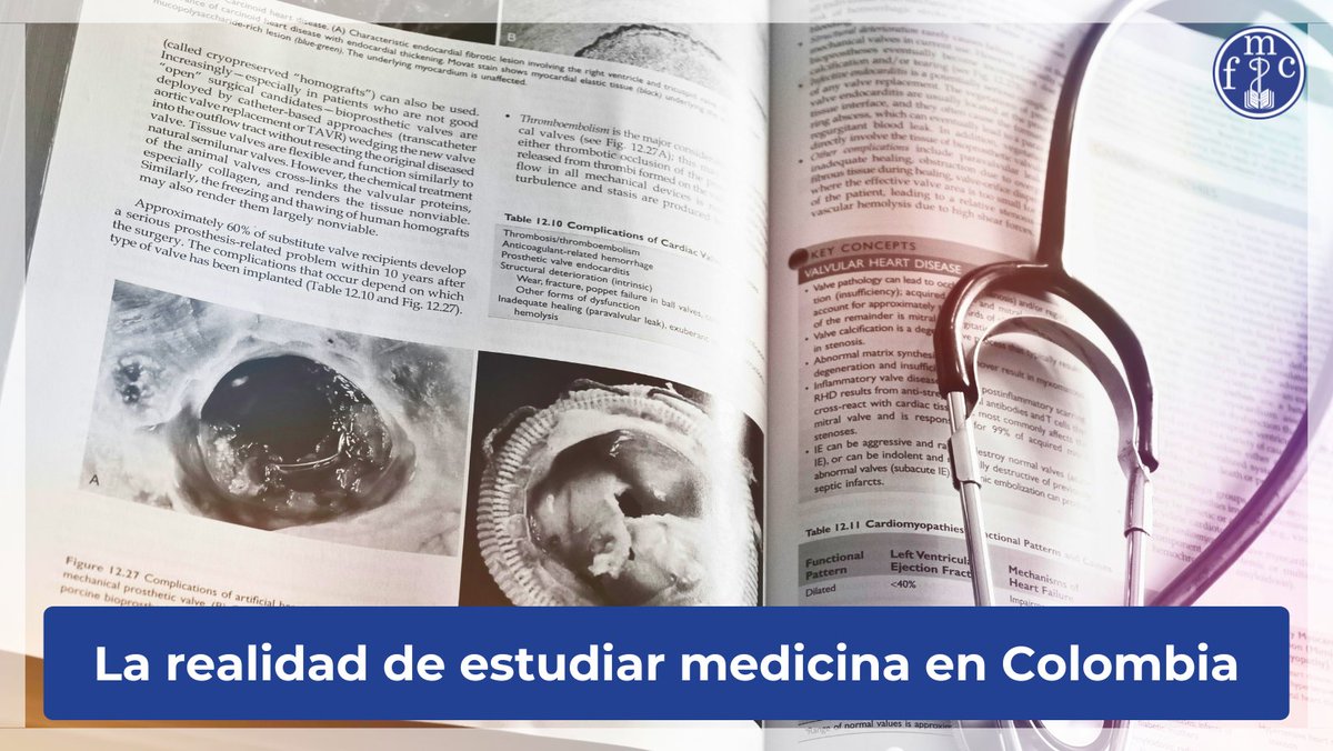 #NoticiaFMC La realidad de estudiar medicina en Col🇨🇴, por la Dra. <a href="/amsoleibe/">Ana María Soleibe</a> de la <a href="/FedemedicaC/">Federación Médica Colombiana FMC</a> 👇
federacionmedicacolombiana.com/2025/06/25/la-…

No incomoda porque sea mentira. Incomoda porque es verdad. En Colombia, ser médico sigue siendo un privilegio, no un derecho accesible. Abrimos hilo 🧵👇