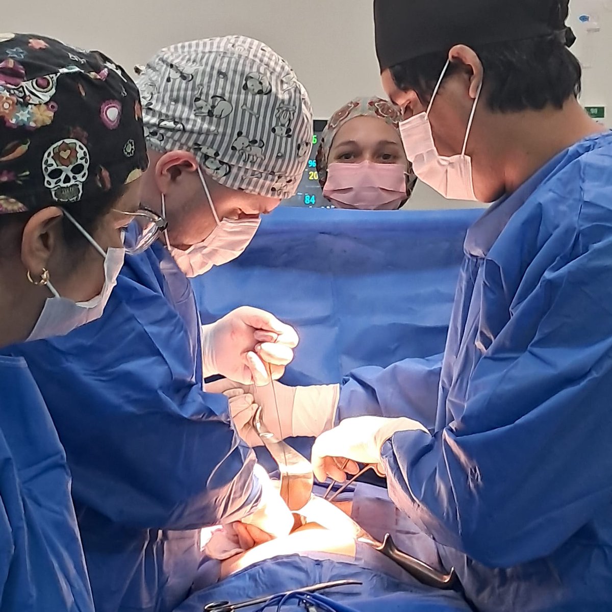 🏥 | Semana quirúrgica en Hospital Distrital de Piribebuy reduce lista de espera

Los pacientes beneficiados cuentan con diagnósticos diversos y serán intervenidos quirúrgicamente para extracción de vesícula por cálculos, extirpación de lipomas, lunares y otros.