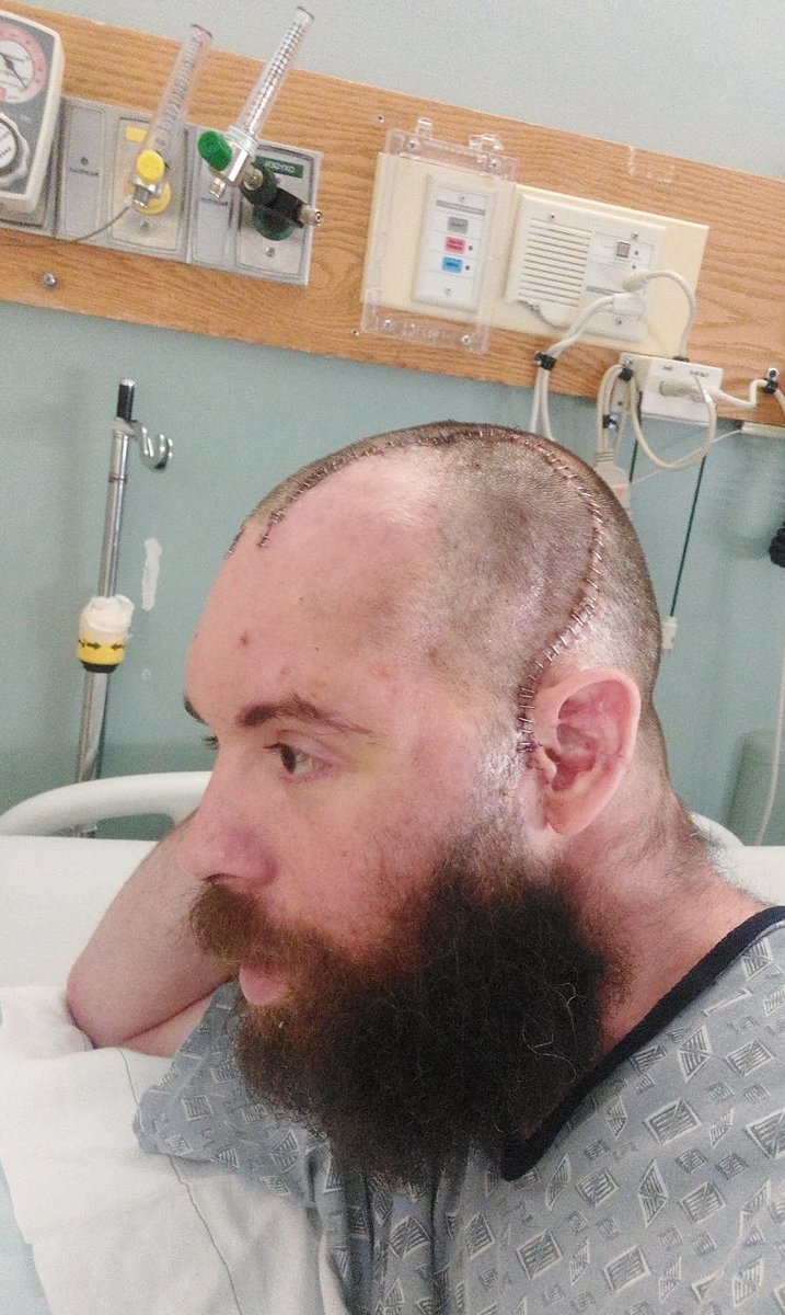 Steven G. Xiarhos (@x4barnstable5th) on Twitter photo TIDMAN STRONG: On June 26, the Public Safety Committee will hear H.2736—Matt’s Law—to ban unsecured gym equipment in prisons. CO Matt Tidman was brutally attacked with a free weight in 2022. He’s blind in one eye, deaf in one ear. Email JointCmte-PublicSafety@malegislature.gov TIDMAN STRONG: On June 26, the Public Safety Committee will hear H.2736—Matt’s Law—to ban unsecured gym equipment in prisons. CO Matt Tidman was brutally attacked with a free weight in 2022. He’s blind in one eye, deaf in one ear. Email JointCmte-PublicSafety@malegislature.gov