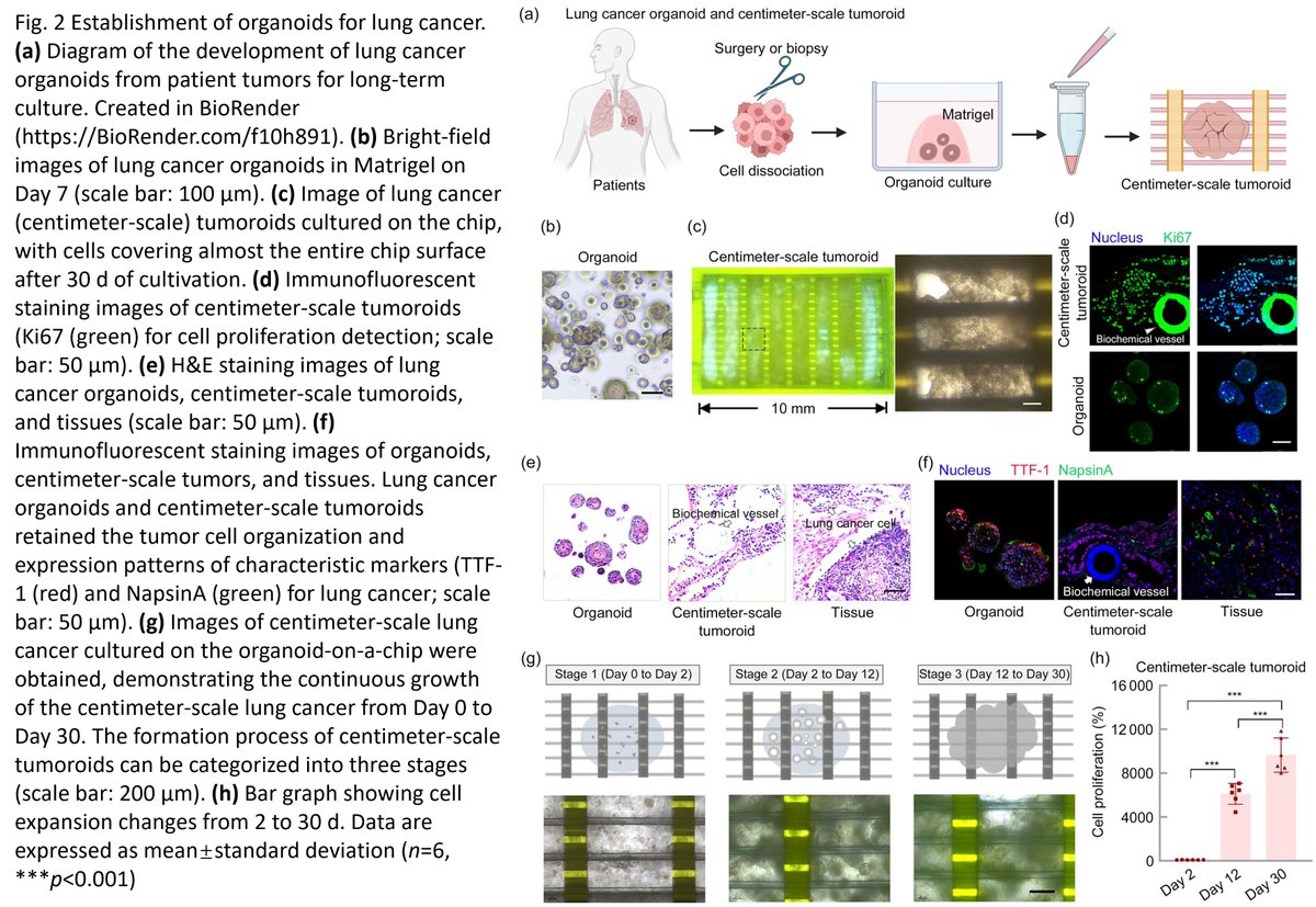Bio-Design and Manufacturing (@biodesignmanuf) on Twitter photo Vascularized organoid-on-a-chip for centimeter-scale organoid cultivation
Learn more: doi.org/10.1631/bdm.24…
<a href="/FudanUniversity/">Fudan University</a> <a href="/NCUniv1921/">Nanchang University</a> <a href="/SASchina/">SASchina</a> Vascularized organoid-on-a-chip for centimeter-scale organoid cultivation
Learn more: doi.org/10.1631/bdm.24…
<a href="/FudanUniversity/">Fudan University</a> <a href="/NCUniv1921/">Nanchang University</a> <a href="/SASchina/">SASchina</a>