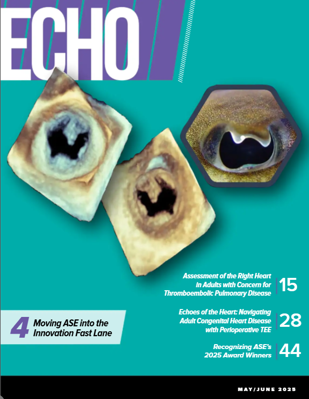 The May/June 2025 #EchoMagazine is online! bit.ly/3ZPR6dg

This exciting, 40+ page issue features:
💜 Assessment of the Right Heart in Adults with Concern for Thromboembolic Pulmonary Disease
💜 PCHD Tips and Tricks
💜 Multiplanar Reconstruction
💜 An #ASE2025 Preview
