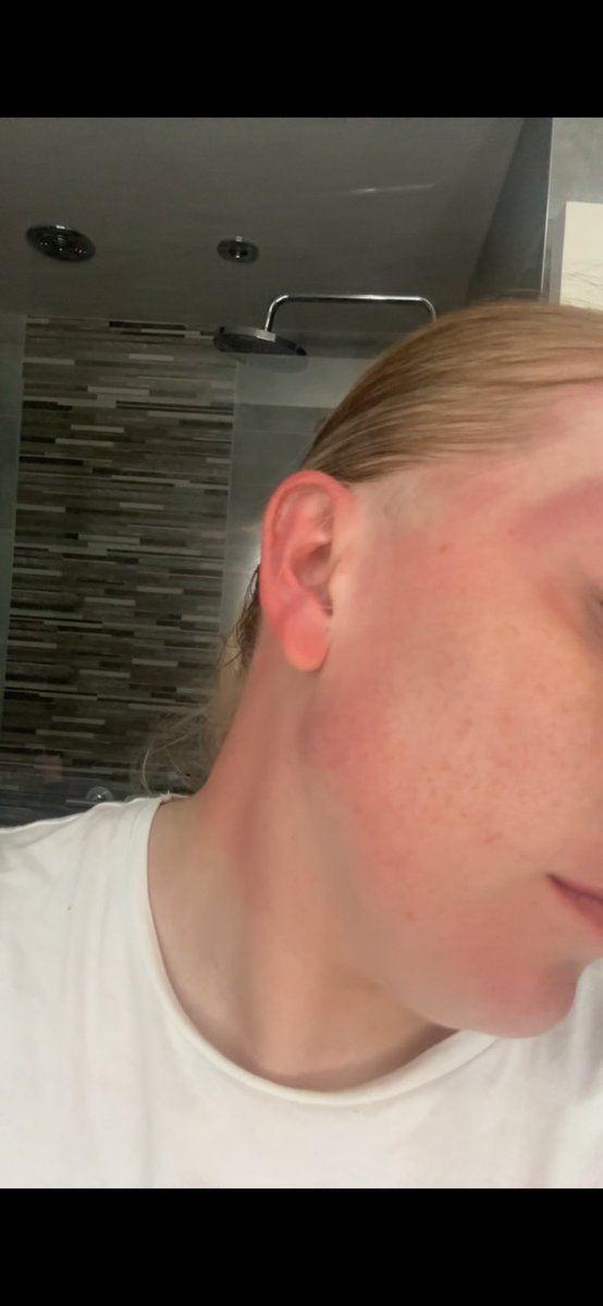 Results from today🙃
Feel like a literal inferno right now, thank god for the lack of pyrotechnics on the summer tour otherwise I think I’d burn to the ground🔥 love summer tour dates so so much🙃
<a href="/ollymurs/">Olly Murs</a>