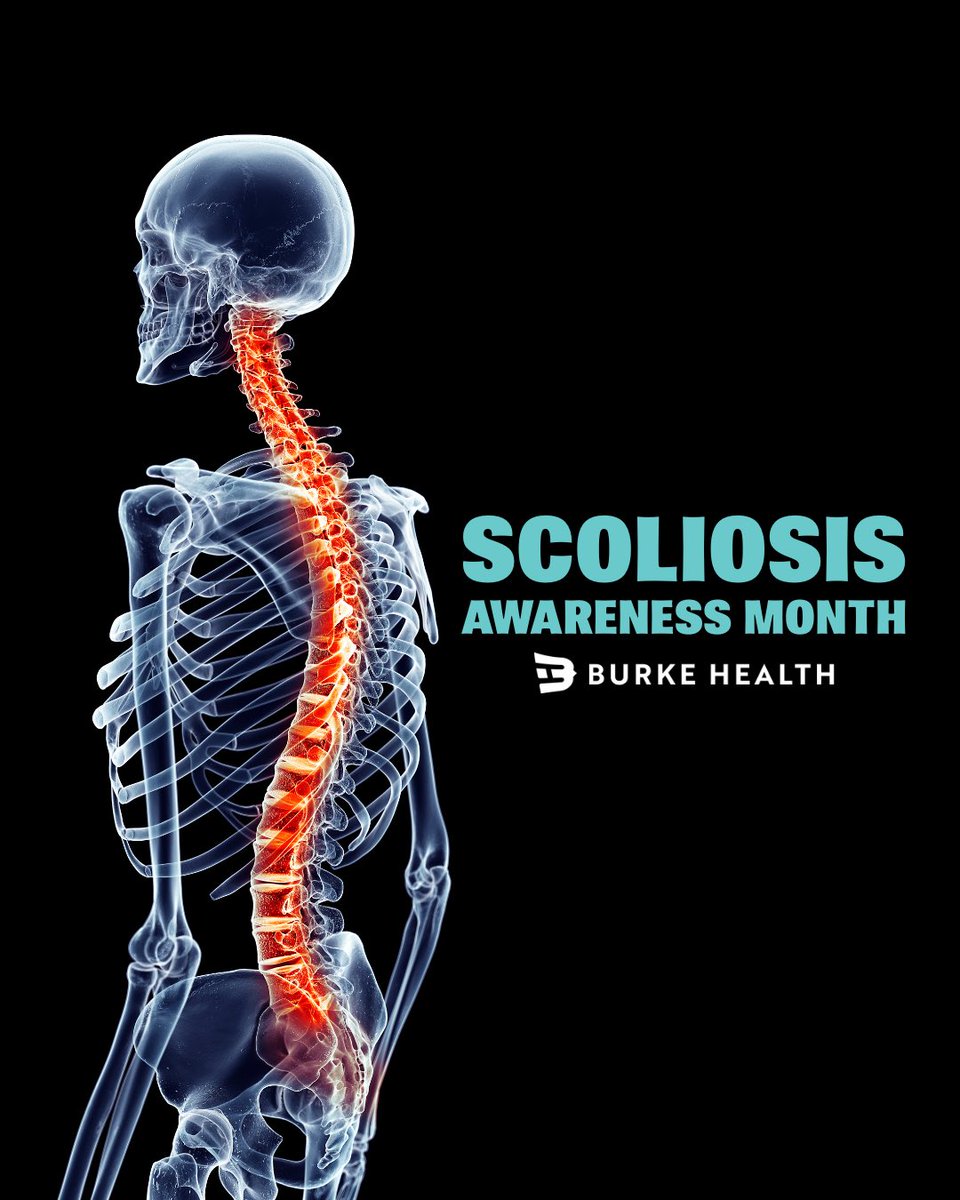 This month we celebrate Scoliosis Awareness Month!
A chance to learn, support, and shine a light on the millions living with scoliosis every day. 

#burkehealth #spinehealth #scoliosisawarenessmonth