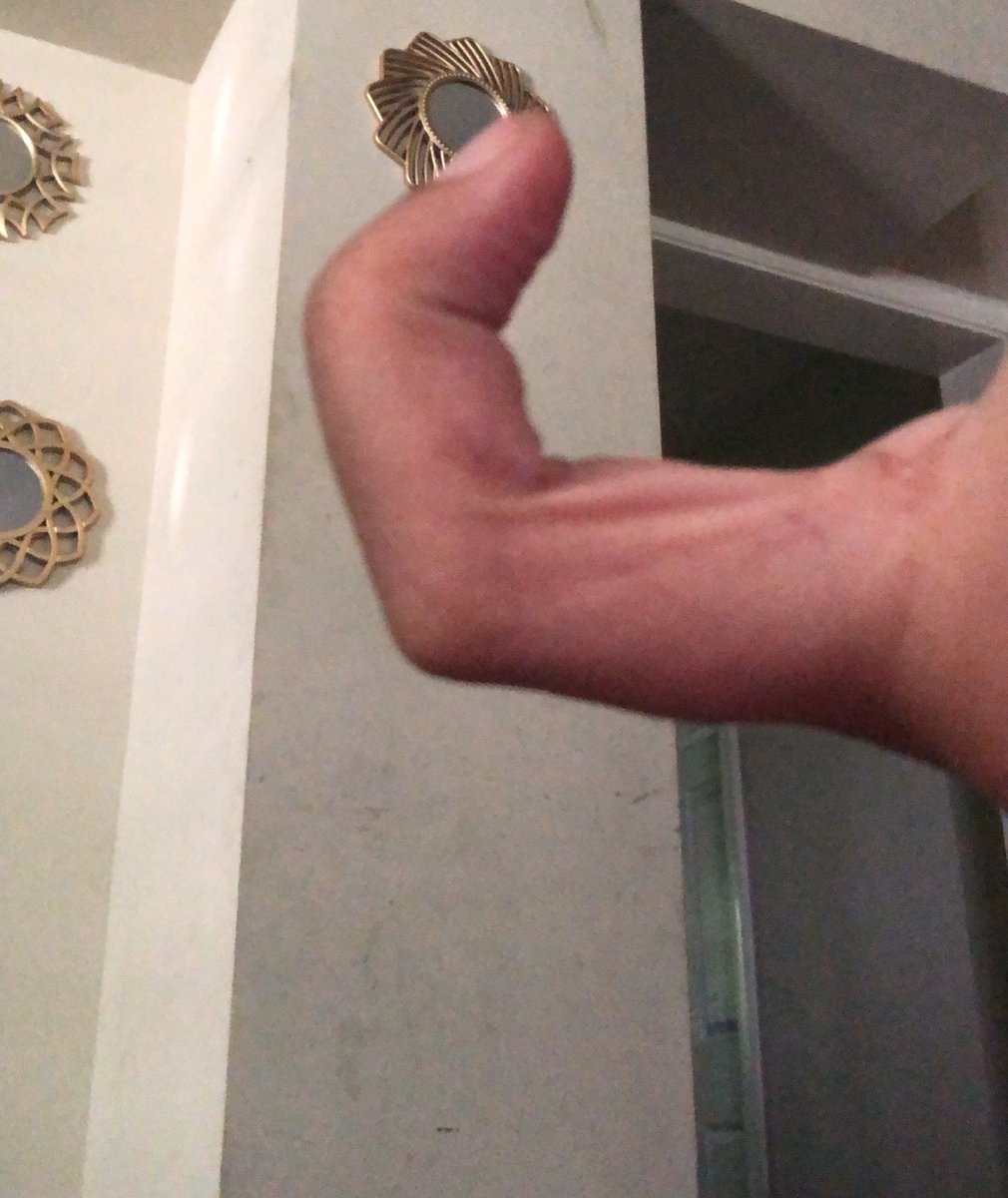 froyosprinkle's tweet image. Feel better princess?