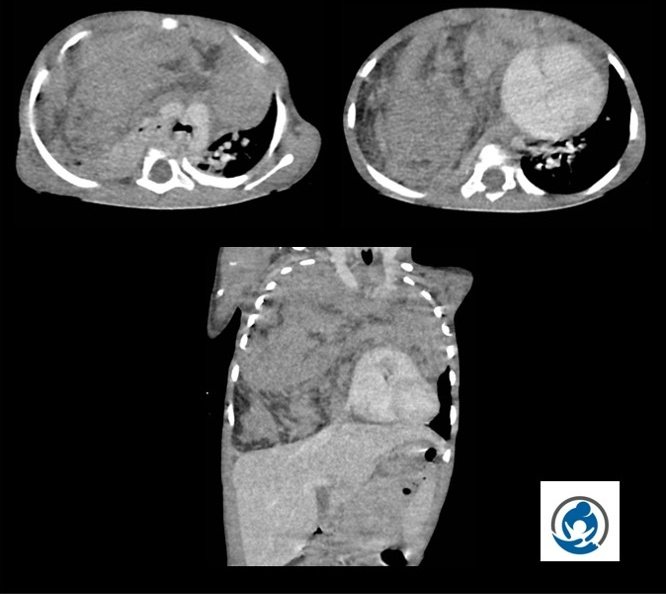 Pediatric Radiology Essence tweet media