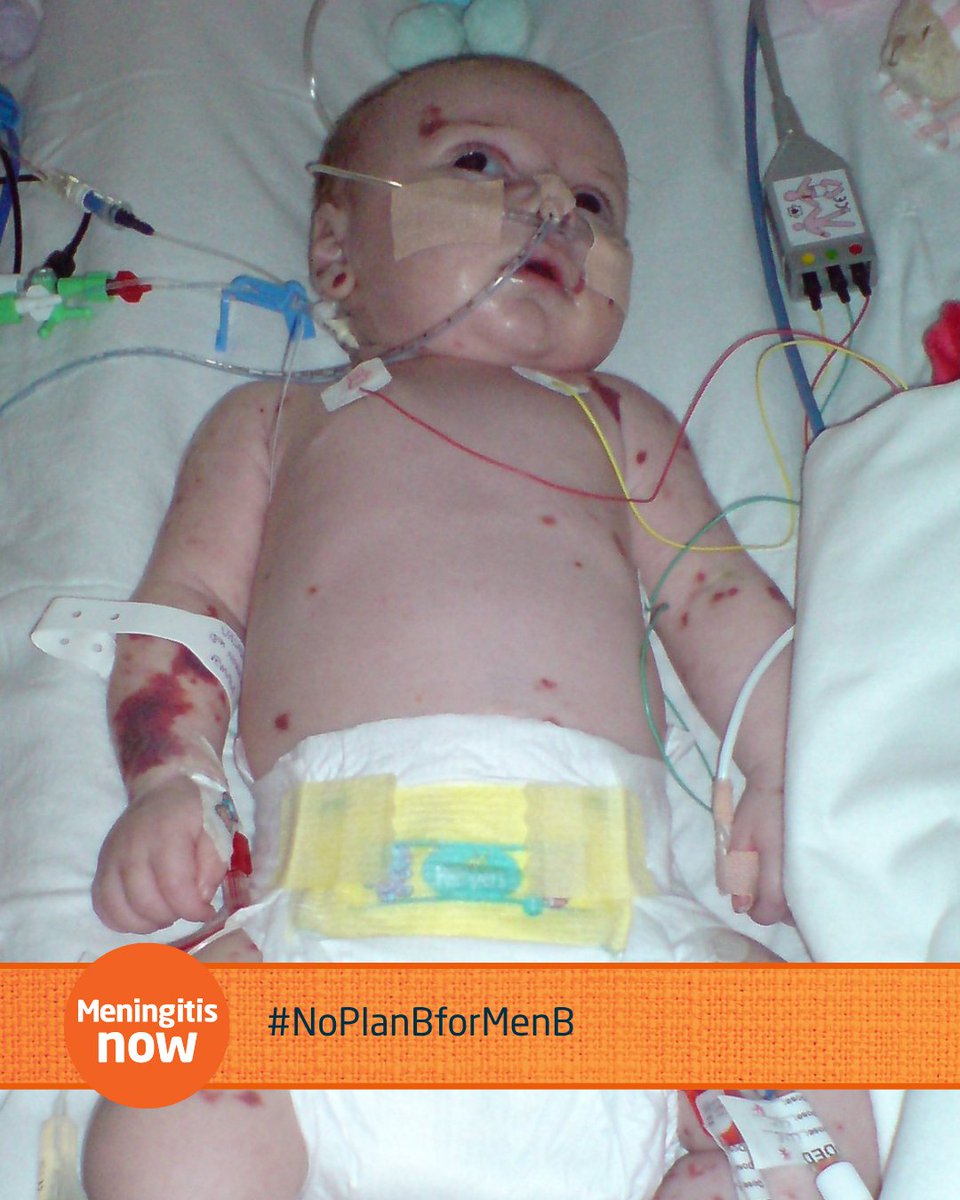 “She was taken into a room and we were told she didn’t have a percentage chance of survival.”

But she did.

“She is our meningitis warrior and we are so, so proud of her.”

#NoPlanBforMenB

Read Jasmine's story here: 🔗 bit.ly/4443xDA