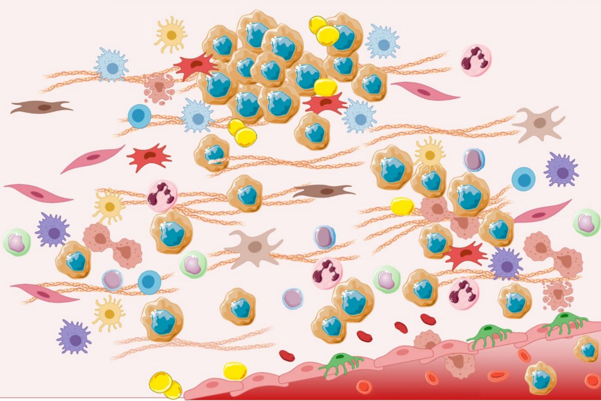 WhiteheadInst's tweet image. Researchers in the Oni lab study how pancreatic cancer cells manipulate their microenvironment to escape immune attack. Read how the Oni lab and others at Whitehead are studying cancer in context: wi.mit.edu/news/company-w…