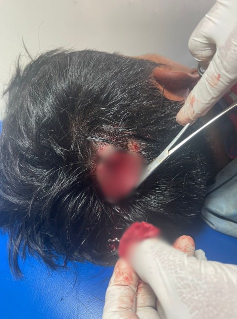 <a href="/Comunalisis/">Comunálisis</a> <a href="/GeoCriticaEc/">Geografía Crítica Ec</a> <a href="/MujeresdFrente/">Mujeres de Frente</a> <a href="/SputnikMundo/">Sputnik Mundo</a> <a href="/LaContraEc/">La Contra</a> <a href="/OITAndina/">OIT Países Andinos</a> <a href="/AmnistiaOnline/">Amnistía Internacional Américas</a> <a href="/FFnspe/">Frente Nacional por la Salud Pueblos del Ecuador</a> <a href="/RadioTemblor/">Radio Temblor Internacional</a> <a href="/LeonidasIzaEc/">Leonidas Iza Salazar</a> Este es un cartucho de escopeta, del tipo antidisturbios, que puede contener perdigones o balas de goma. Estos cartuchos, aunque “no letales”, pueden causar lesiones graves o incluso muerte si se disparan a corta distancia, tal como ocurrió con Bladimir S. el día de ayer.