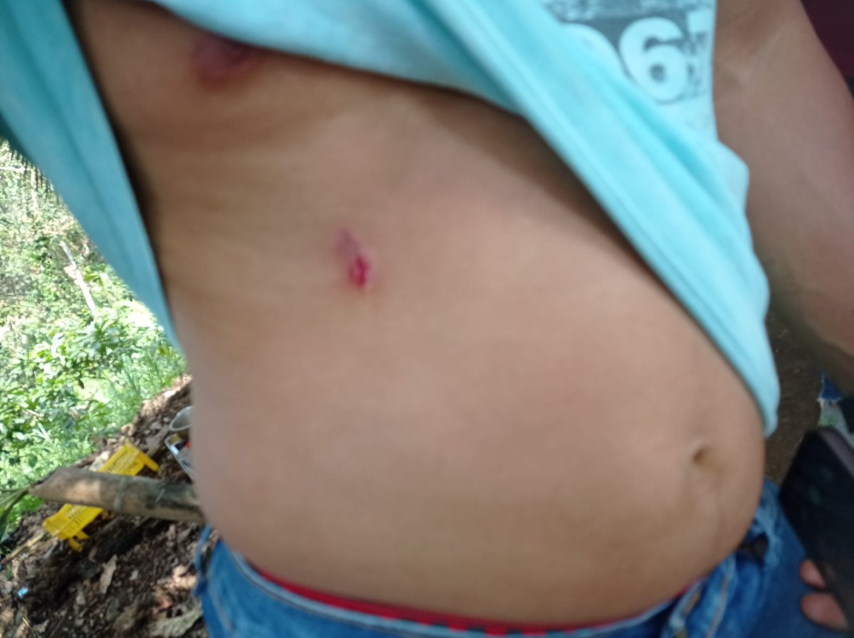 <a href="/Comunalisis/">Comunálisis</a> <a href="/GeoCriticaEc/">Geografía Crítica Ec</a> <a href="/MujeresdFrente/">Mujeres de Frente</a> <a href="/SputnikMundo/">Sputnik Mundo</a> <a href="/LaContraEc/">La Contra</a> <a href="/OITAndina/">OIT Países Andinos</a> <a href="/AmnistiaOnline/">Amnistía Internacional Américas</a> <a href="/FFnspe/">Frente Nacional por la Salud Pueblos del Ecuador</a> <a href="/RadioTemblor/">Radio Temblor Internacional</a> <a href="/LeonidasIzaEc/">Leonidas Iza Salazar</a> A continuación fotografías del uso ilegal de estás armas que ponen en riesgo la integridad y la vida de las familias del cantón Las Naves, pues los policías están disparando directamente a los cuerpos por defender su territorio de la minería. Hasta el momento hay 5 heridos.