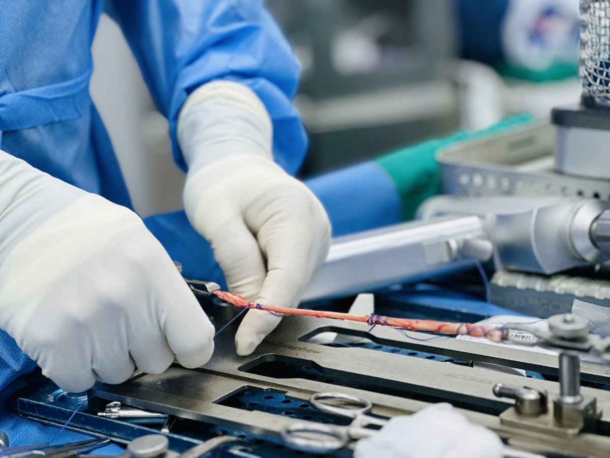 <a href="/Presidencia_Ec/">Presidencia Ecuador 🇪🇨</a> <a href="/DanielNoboaOk/">Daniel Noboa Azin</a> <a href="/Salud_Ec/">Ministerio de Salud Pública 🇪🇨</a> <a href="/Salud_CZ4/">Coordinación Zonal 4 🇪🇨</a> <a href="/DraAuraLopez/">Aura López</a> <a href="/marcelo_daza/">Marcelo Daza</a> La rotura de este tejido ocurre frecuentemente en deportistas que sufren traumas en las canchas, por lo que es preciso retirarlo y reemplazarlo por otra estructura, en este caso por el tendón de la "pata de ganso", que con el tiempo asumirá la función del ligamento roto. 3/7