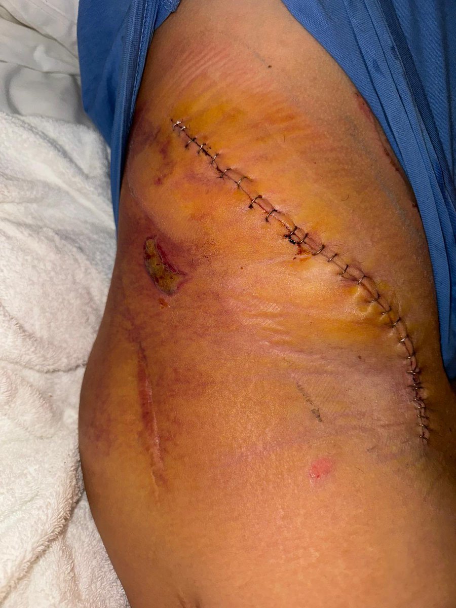 James Ellison tweet media