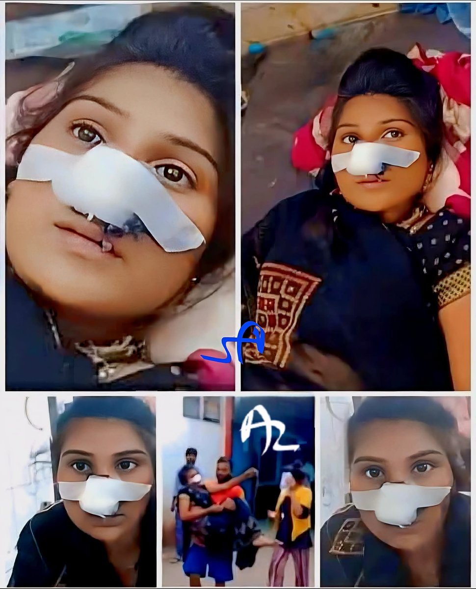 Zarafat khan (Journalist) (@mdzarafat) on Twitter photo हरदोई : पत्नी बार-बार मायके के बहाने अपने बॉयफ्रेंड से मिलने जाती थी जिसके बाद गुस्से में आकर पति ने पत्नी की नाक काट दी। पत्नी का किसी सूरज नाम के लड़के से अफेयर था और इसकी जानकारी उसके पति को लग गई थी। <a href="/NCMIndiaa/">NCMIndia Council For Men Affairs</a>
<a href="/SahodarIndia/">Sahodar - Equality For Men</a> <a href="/MenTooSave/">MenToo</a> <a href="/BharatiyaMen/">Bharatiya Men</a>
<a href="/Manish_NSPF/">Manish Shrivastava</a> हरदोई : पत्नी बार-बार मायके के बहाने अपने बॉयफ्रेंड से मिलने जाती थी जिसके बाद गुस्से में आकर पति ने पत्नी की नाक काट दी। पत्नी का किसी सूरज नाम के लड़के से अफेयर था और इसकी जानकारी उसके पति को लग गई थी। <a href="/NCMIndiaa/">NCMIndia Council For Men Affairs</a>
<a href="/SahodarIndia/">Sahodar - Equality For Men</a> <a href="/MenTooSave/">MenToo</a> <a href="/BharatiyaMen/">Bharatiya Men</a>
<a href="/Manish_NSPF/">Manish Shrivastava</a>