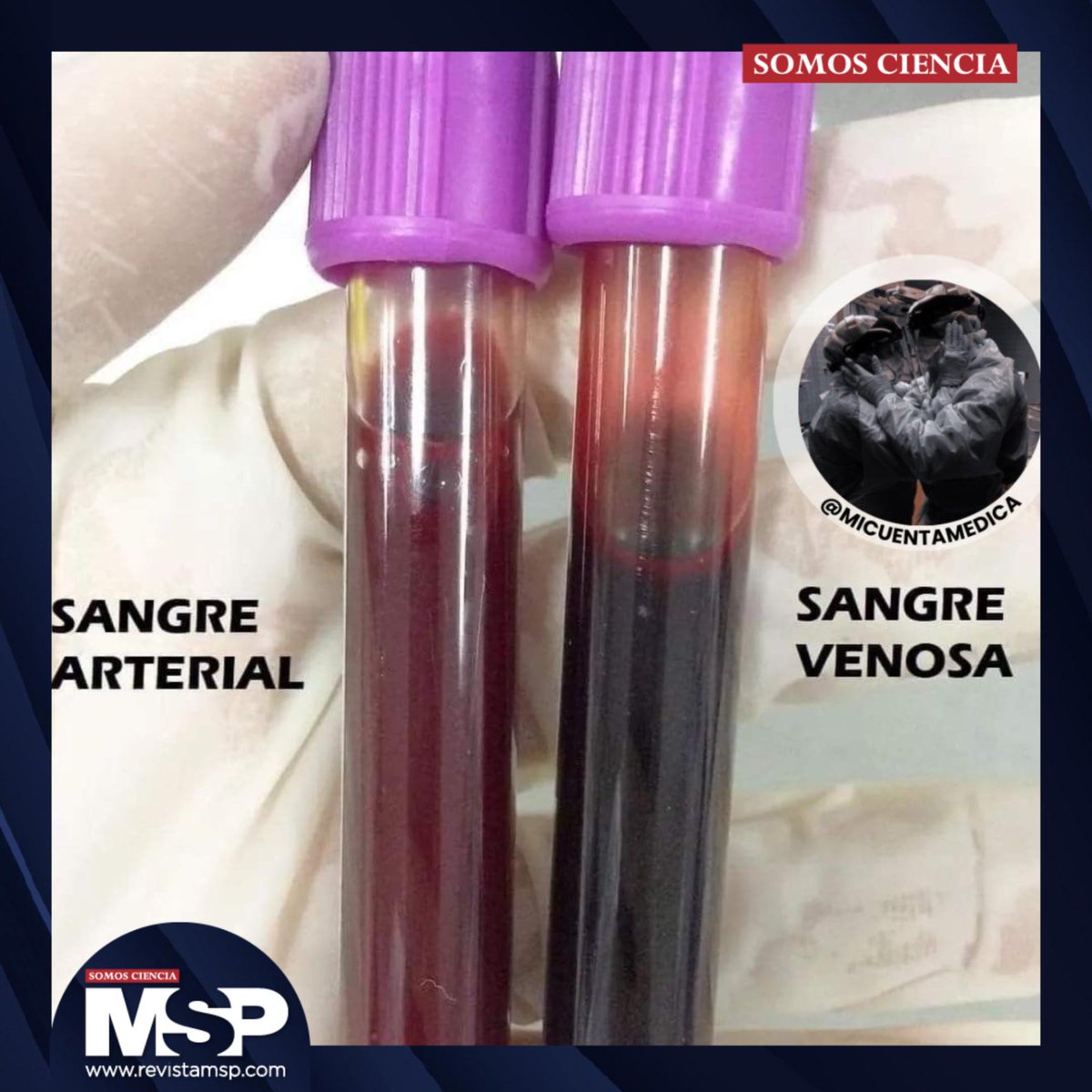 Izquierda sangre arterial:

Brillante, oxigenada, llena de vida. Sale del corazón  hacia cada rincón del cuerpo, llevando oxígeno, energía.

Derecha, la sangre venosa:
Oscura, densa, cargada de CO₂. Regresa para ser purificada y empezar de nuevo.

📸Mi cuenta médica