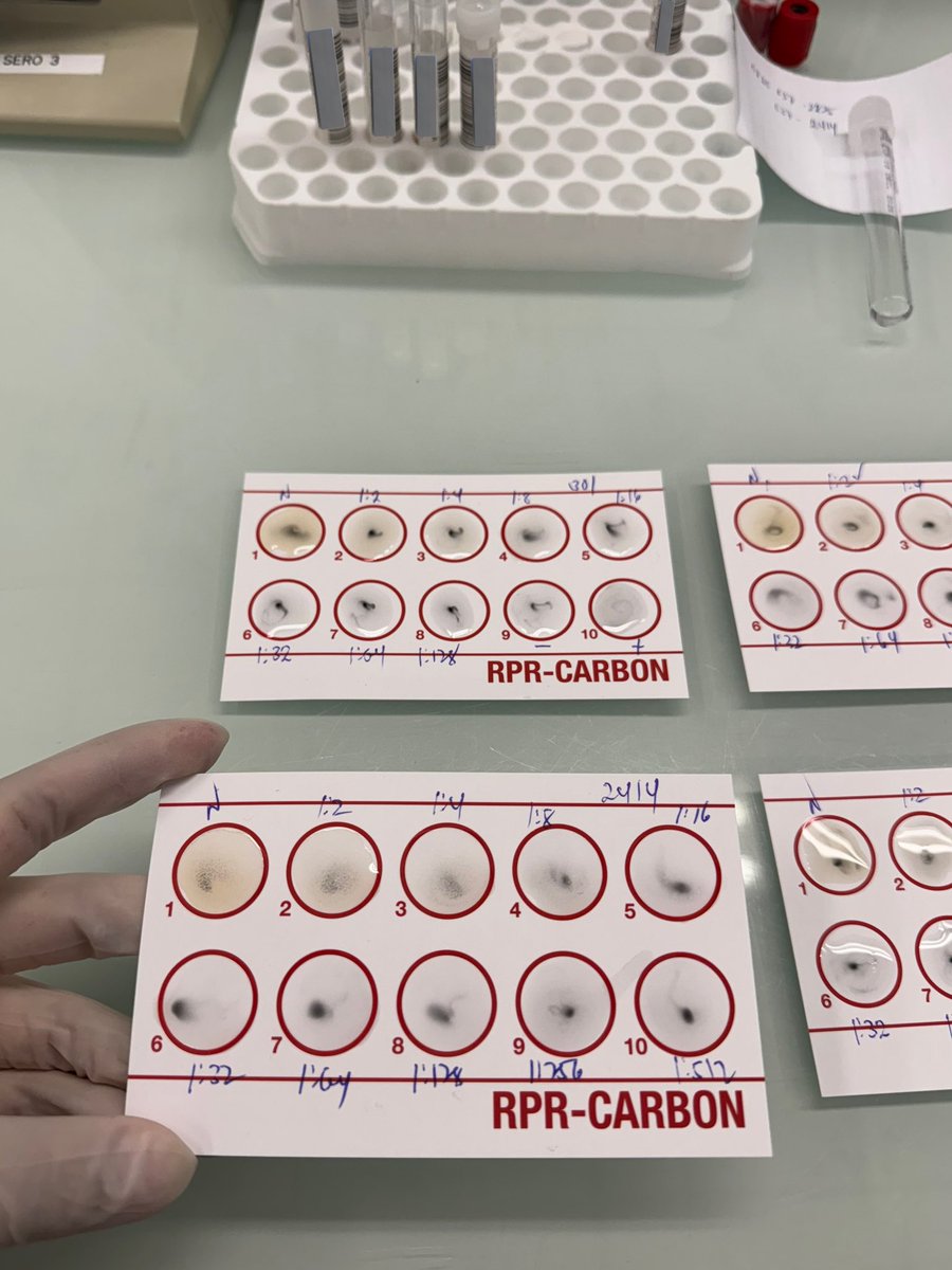 _RaoomAb's tweet photo. 6th rotation | serology 🧪✅ https://t.co/5rfgPXxQ4x
