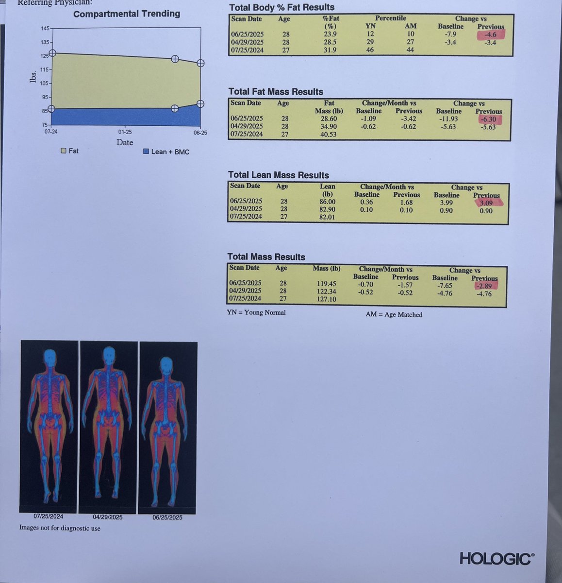 LauraSVBB's tweet photo. Have been locked in on fitness!

Baseline DEXA was at a major low point, but this year has been 📈!

Focus has been on optimizing fun and social workouts, the results are paying off. 

Trying to maximize bone density and muscle mass pre-30 😬 https://t.co/JfLpAVbout