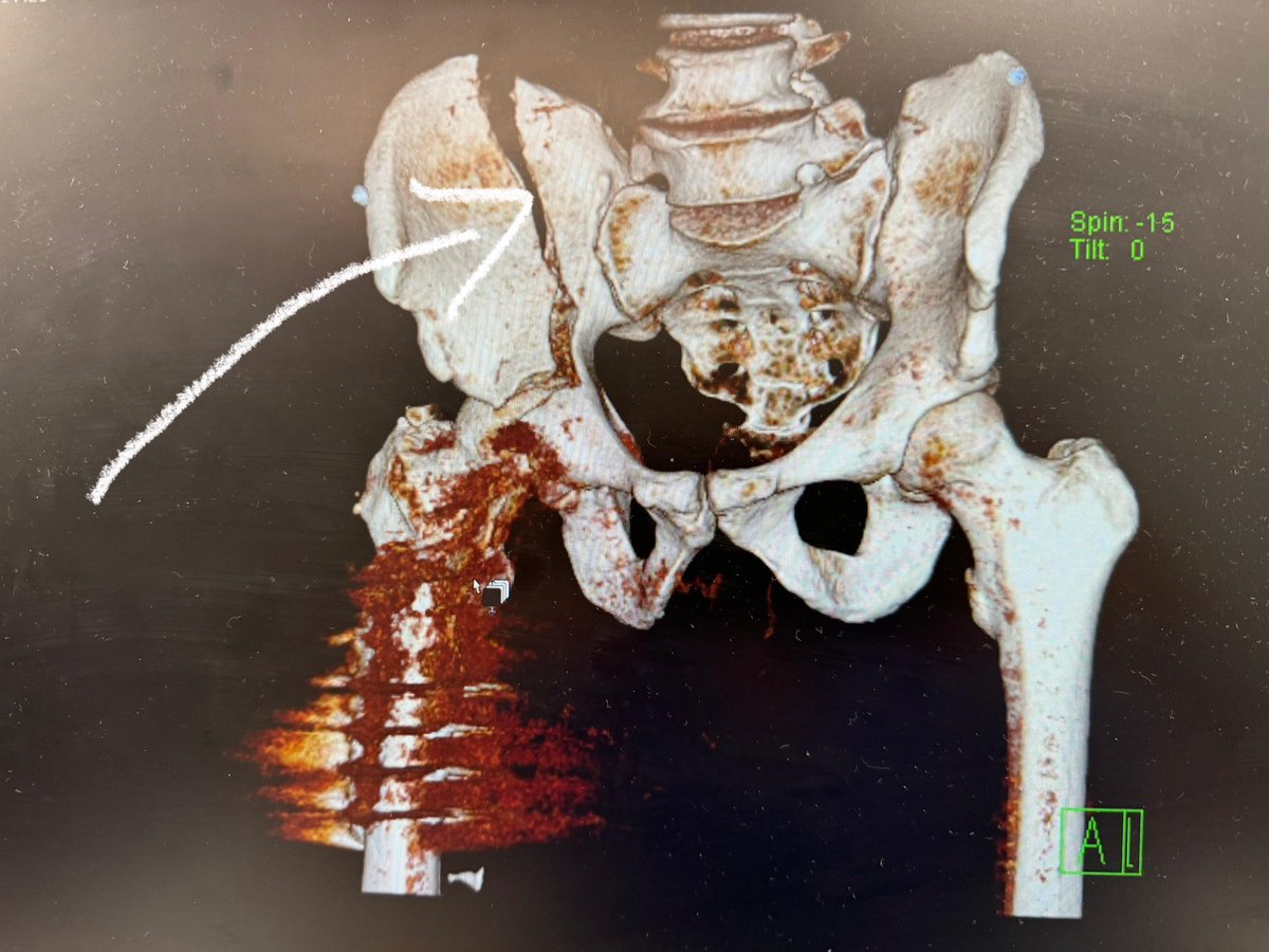 James Ellison tweet media