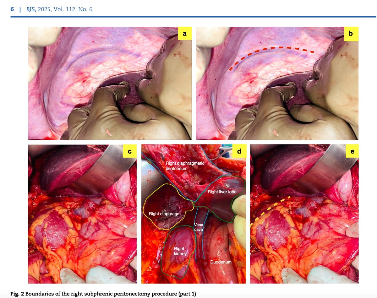 Aditi Bhatt tweet media